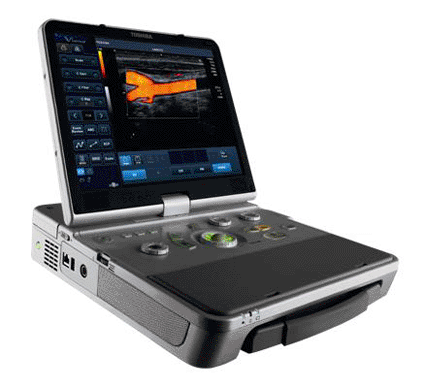 Image: The Viamo laptop ultrasound system (photo courtesy Toshiba Medical Systems).